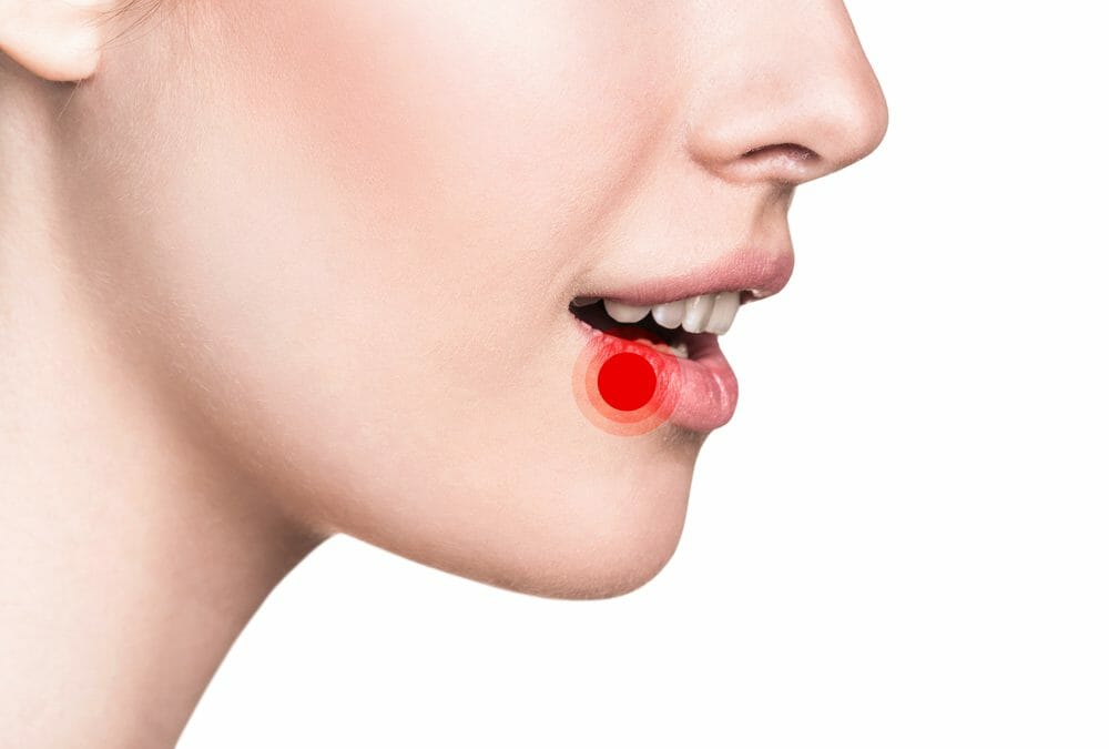 Woman With Red Dot on Her Lip