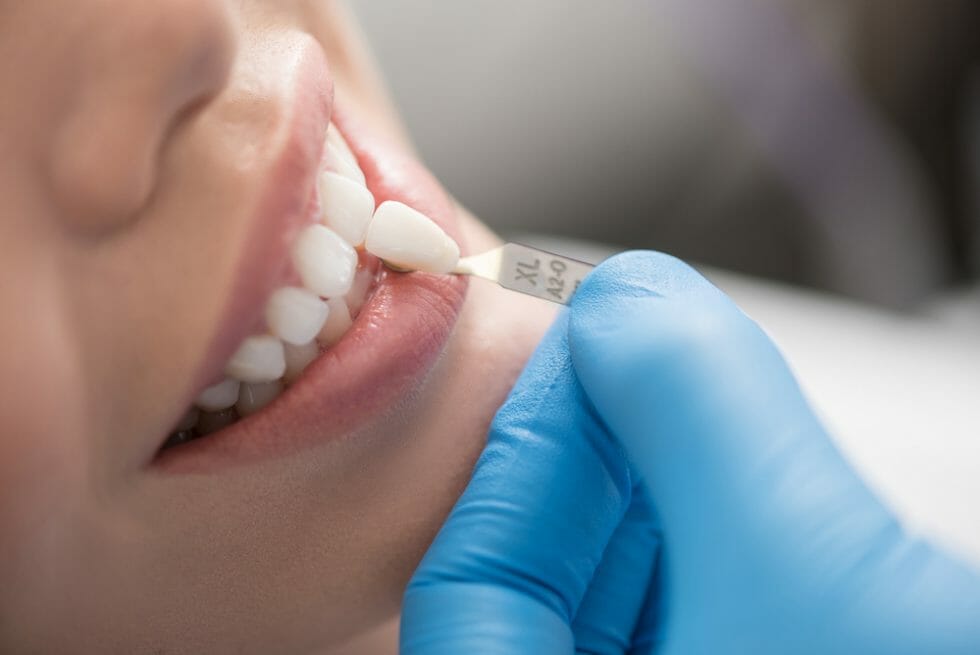 7 Common Dental Crown Problems and How to Address Them
