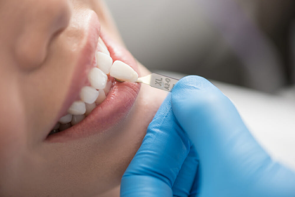 dentist picking shade for a patient's dental crown