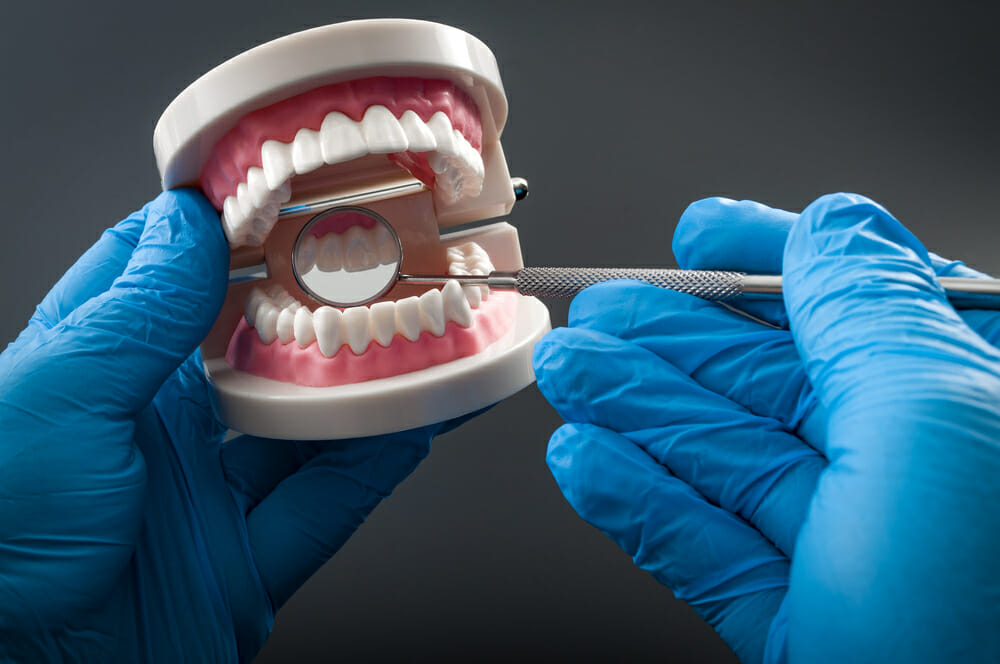 teeth examination display on mold