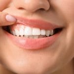 woman showing her white straight teeth and healthy gums