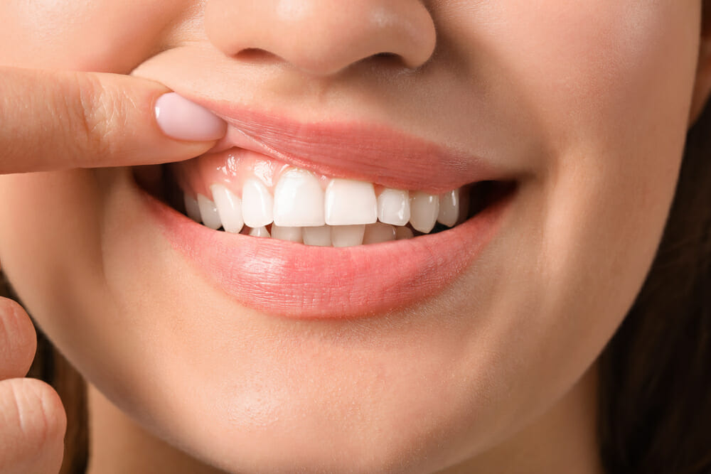 woman showing gums