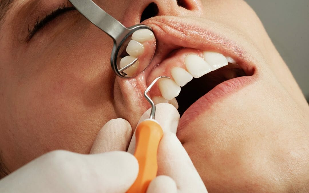 Dentist Checking Teeth