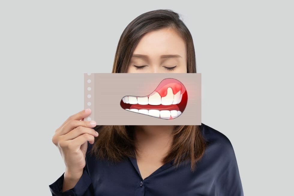 Learn to recognize the 4 stages of periodontal disease