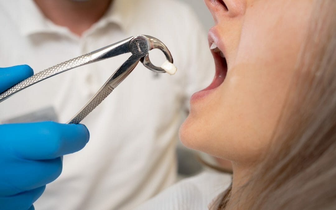 woman getting tooth pulled