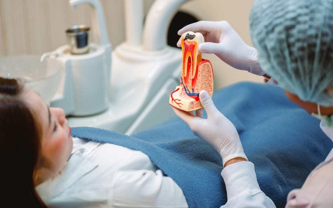 What to Expect During a Root Canal Treatment