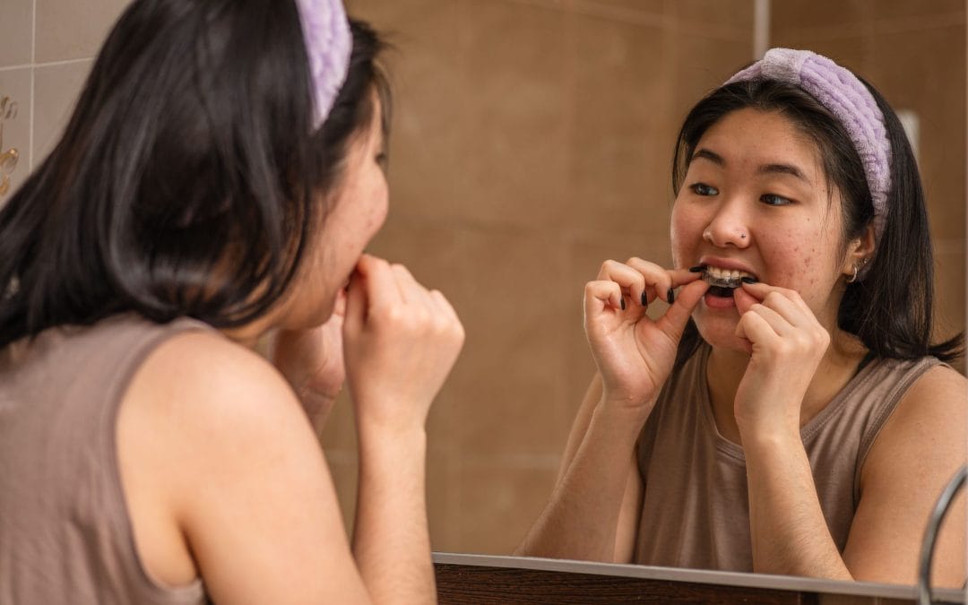 The Benefits of Nightguards for Teeth Grinding and Jaw Pain