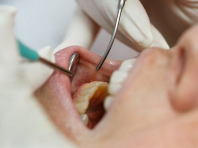 water pik being used during gum exam