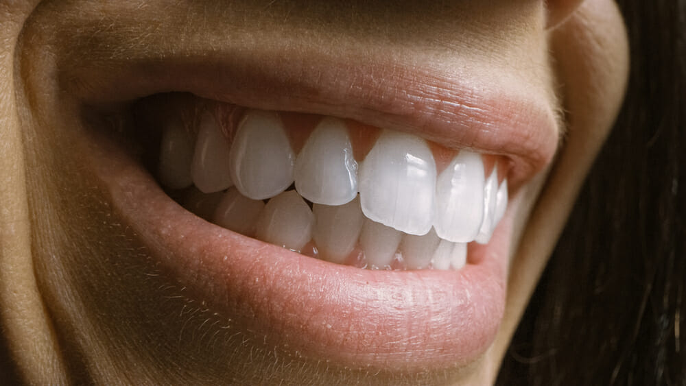 closeup of smiling mouth with white teeth