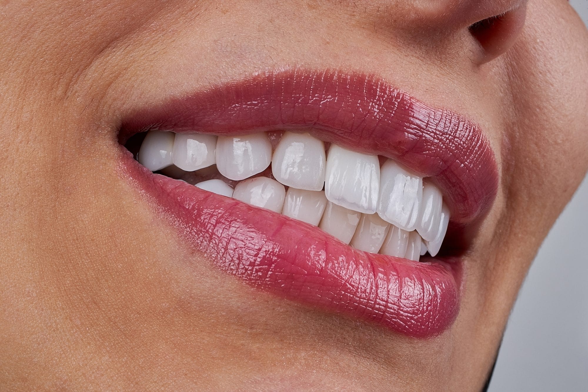 Slender Tooth Bonding vs Veneers: Your Guide to Small Tooth Fixes - Dentistry of West ...